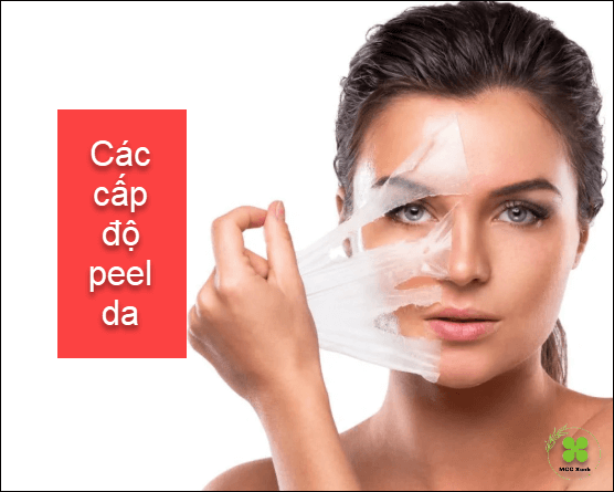 cac-cap-do-peel-da
